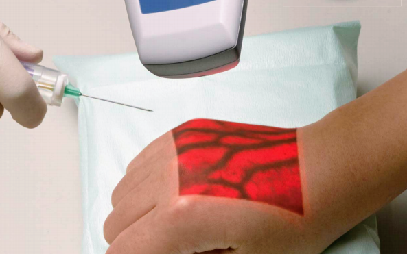 静脈可視化装置導入について | 大橋内科